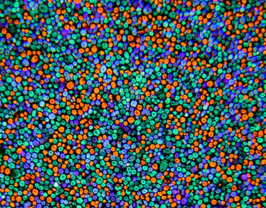 Agrandir Vue microscopique d’une plaque autochrome permettant de distinguer les grains d’amidon colorés